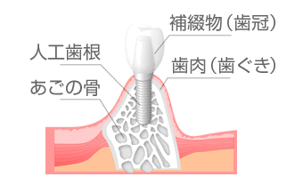 sec1_image